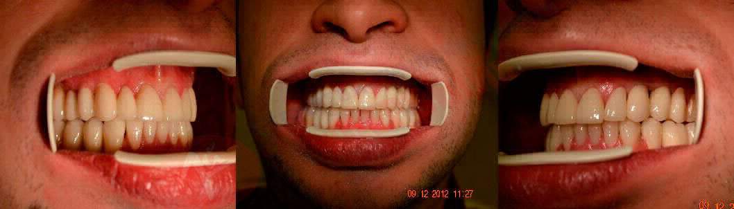 Комплексное стоматологическое лечение