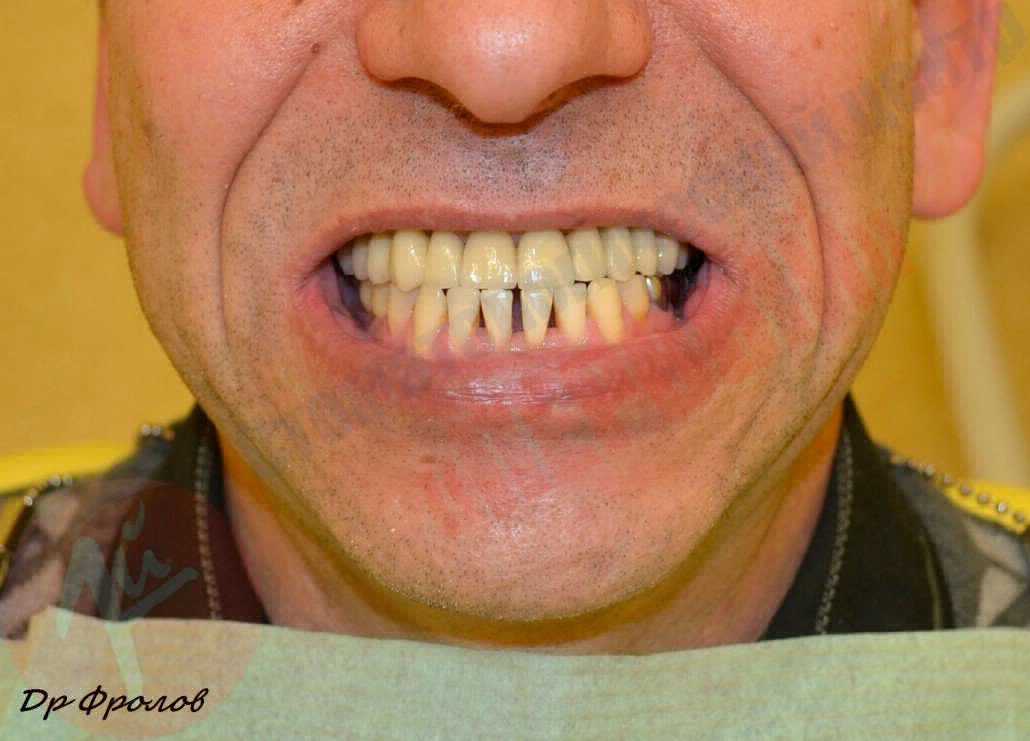 Комплексное стоматологическое лечение 3