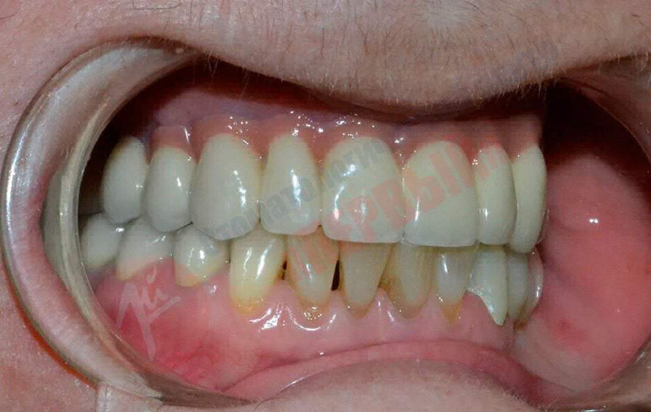 Комплексное стоматологическое лечение 2